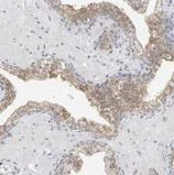 Immunohistochemistry (Formalin/PFA-fixed paraffin-embedded sections) - Anti-FLG2 antibody (AB122011)