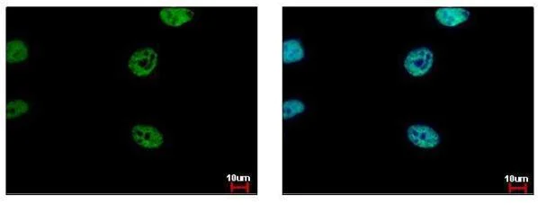 Immunocytochemistry/ Immunofluorescence - Anti-FLI1 antibody (AB153909)