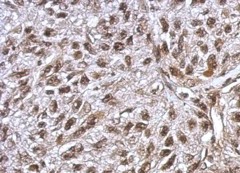 Immunohistochemistry (Formalin/PFA-fixed paraffin-embedded sections) - Anti-FLI1 antibody (AB153909)