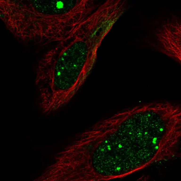 Immunocytochemistry/ Immunofluorescence - Anti-FLI1 Antibody (AB327277)