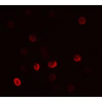 Immunocytochemistry/ Immunofluorescence - Anti-FLI1 antibody - C-terminal (AB180902)