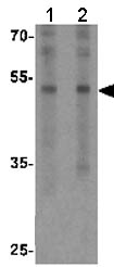 Western blot - Anti-FLI1 antibody - C-terminal (AB180902), expandable thumbnail
