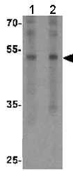 Western blot - Anti-FLI1 antibody - C-terminal (AB180902)