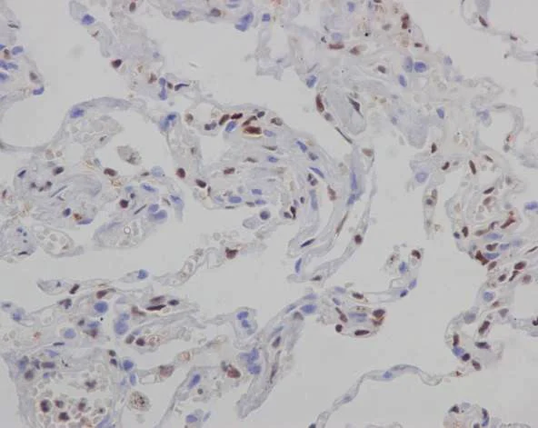 Immunohistochemistry (Formalin/PFA-fixed paraffin-embedded sections) - Anti-FLI1 antibody [EPR4646] (AB133485)