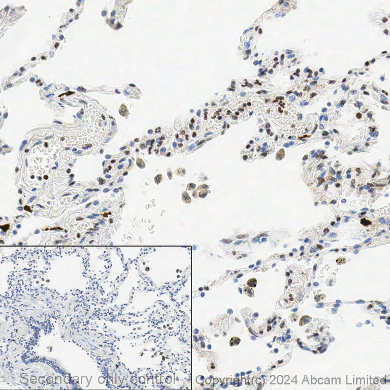 Immunohistochemistry (Formalin/PFA-fixed paraffin-embedded sections) - Anti-FLI1 antibody [EPR4646] - BSA and Azide free (AB215987)