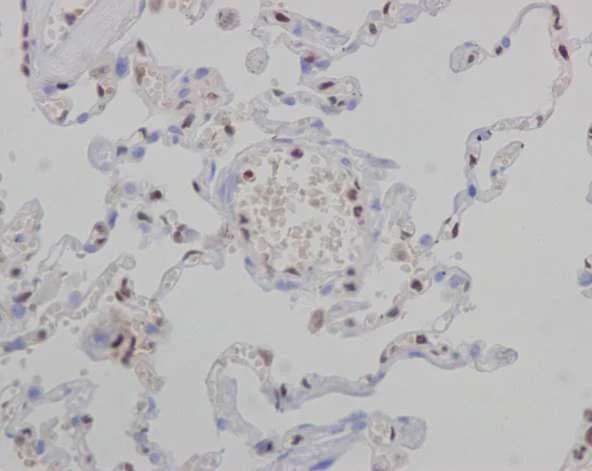 Immunohistochemistry (Formalin/PFA-fixed paraffin-embedded sections) - Anti-FLI1 antibody [EPR4646] - BSA and Azide free (AB215987)