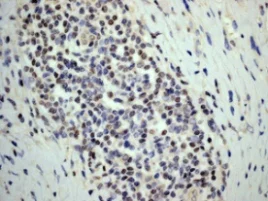 Immunohistochemistry (Formalin/PFA-fixed paraffin-embedded sections) - Anti-FLI1 antibody [EPR4646] - BSA and Azide free (AB215987)