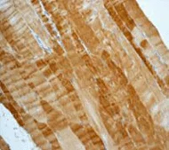 Immunohistochemistry (Formalin/PFA-fixed paraffin-embedded sections) - Anti-Flightless I antibody [EPR4201] (AB108594)