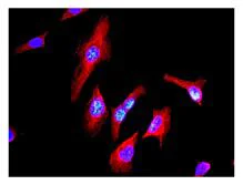 Immunocytochemistry/ Immunofluorescence - Anti-Flightless I antibody [EPR4202(2)] - BSA and Azide free (AB247746)