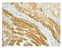Immunohistochemistry (Formalin/PFA-fixed paraffin-embedded sections) - Anti-Flightless I antibody [EPR4202(2)] - BSA and Azide free (AB247746)