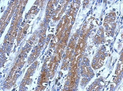 Immunohistochemistry (Formalin/PFA-fixed paraffin-embedded sections) - Anti-FLIP antibody (AB227194)
