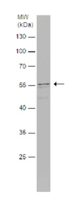 Western blot - Anti-FLIP antibody (AB227194)