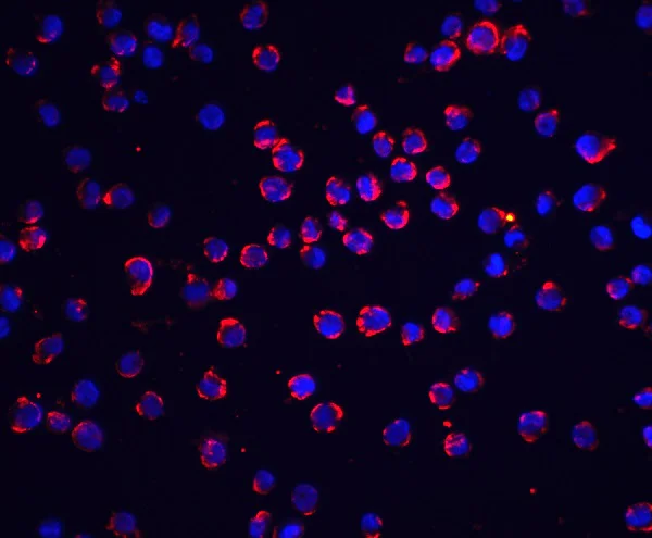 Immunocytochemistry/ Immunofluorescence - Anti-FLIP antibody (AB6144)