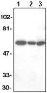 Western blot - Anti-FLIP antibody (AB6144)