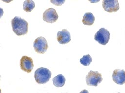 Immunocytochemistry/ Immunofluorescence - Anti-FLIP antibody (AB8421), expandable thumbnail