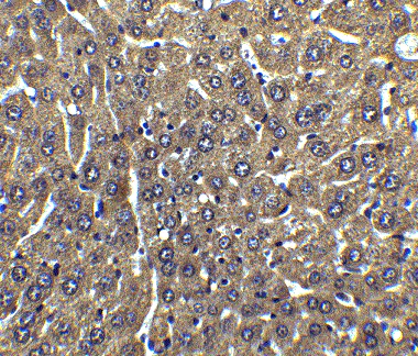 Immunohistochemistry (Formalin/PFA-fixed paraffin-embedded sections) - Anti-FLIP antibody (AB8421)