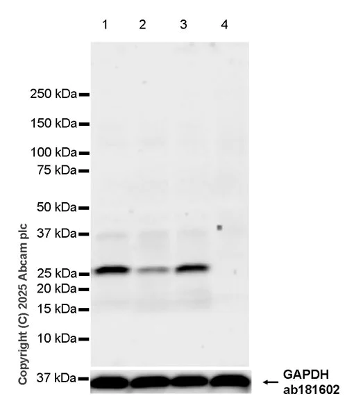 Western blot - Anti-FLIPs (short isoform) antibody [EPR29011-104] (AB323748)