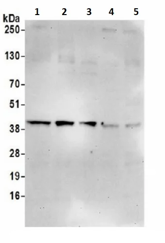 Western blot - Anti-FLJ11506 antibody (AB241294)