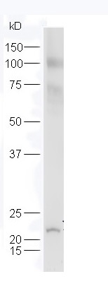 Western blot - Anti-FLJ14154 antibody (AB217315)