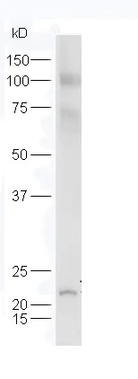 Western blot - Anti-FLJ14154 antibody (AB217315)