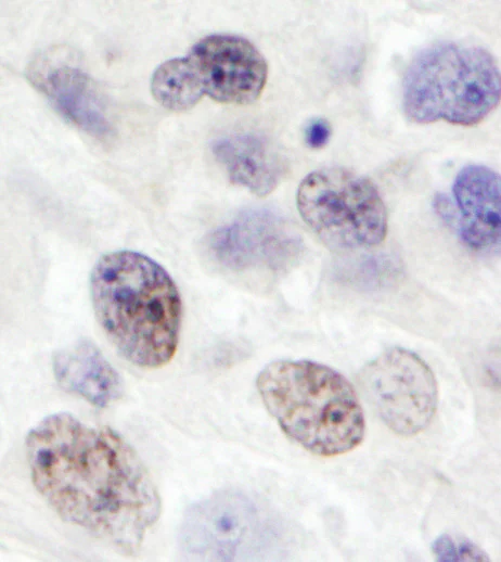 Immunohistochemistry (Formalin/PFA-fixed paraffin-embedded sections) - Anti-FLJ20530 antibody (AB18050)