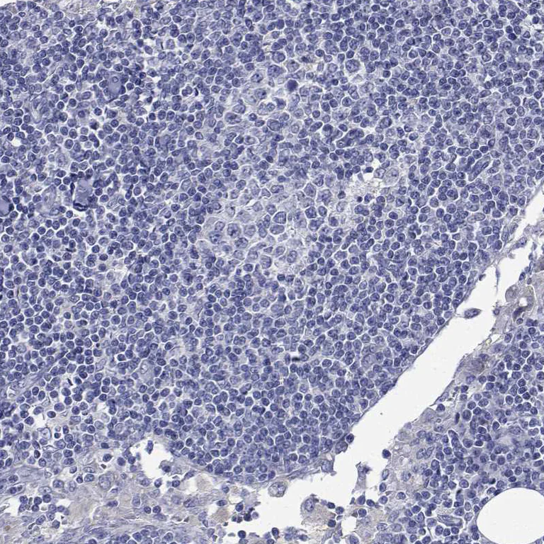 Immunohistochemistry (Formalin/PFA-fixed paraffin-embedded sections) - Anti-FLJ23834 antibody (AB121337)