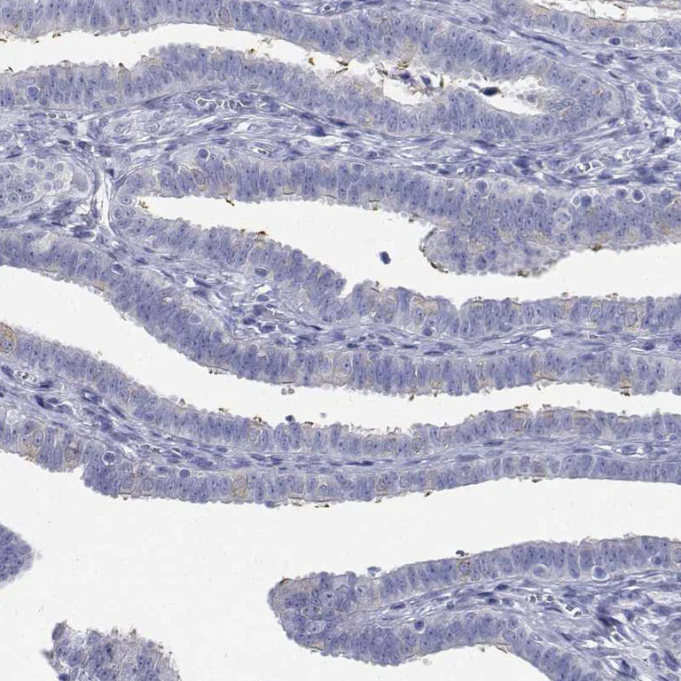 Immunohistochemistry (Formalin/PFA-fixed paraffin-embedded sections) - Anti-FLJ23834 antibody (AB121337)
