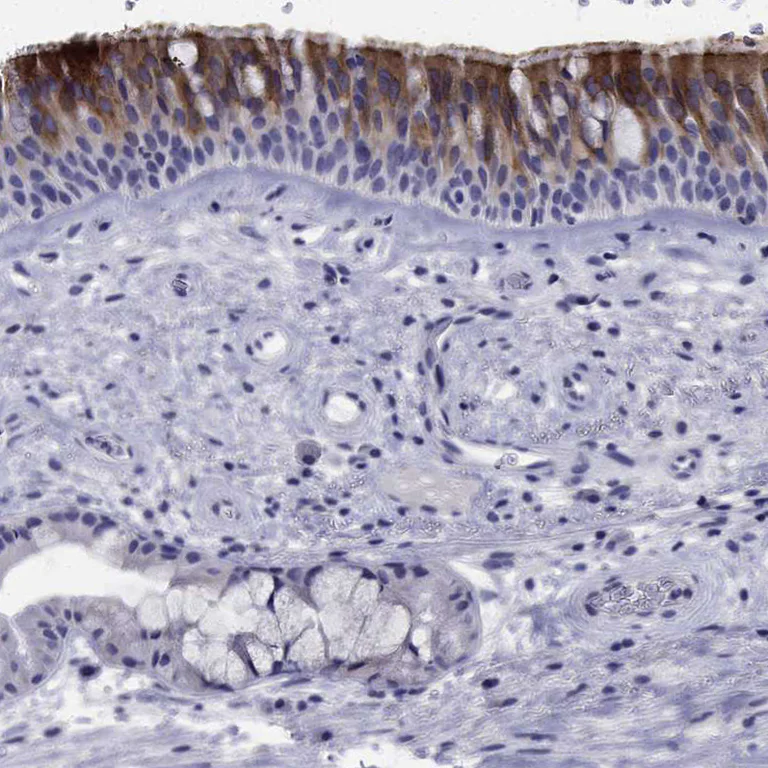 Immunohistochemistry (Formalin/PFA-fixed paraffin-embedded sections) - Anti-FLJ23834 antibody (AB121337)