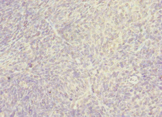Immunohistochemistry (Formalin/PFA-fixed paraffin-embedded sections) - Anti-FLJ30934 antibody (AB230112)