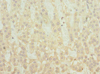 Immunohistochemistry (Formalin/PFA-fixed paraffin-embedded sections) - Anti-FLJ30934 antibody (AB230112)