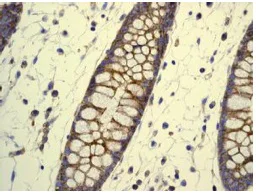 Immunohistochemistry (Formalin/PFA-fixed paraffin-embedded sections) - Anti-Flotillin 1 antibody [EPR6041] (AB133497)