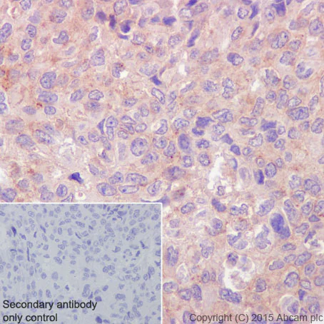 Immunohistochemistry (Formalin/PFA-fixed paraffin-embedded sections) - Anti-Flotillin 1 antibody [EPR6041] (AB133497)