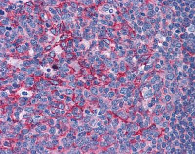 Immunohistochemistry (Formalin/PFA-fixed paraffin-embedded sections) - Anti-Flotillin 2/ESA antibody (AB113661)