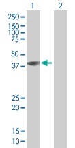 Western blot - Flotillin 2 / ESA overexpression 293T lysate (whole cell) (AB94259)