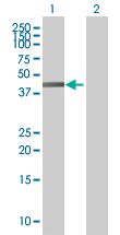 Western blot - Flotillin 2 / ESA overexpression 293T lysate (whole cell) (AB94260)