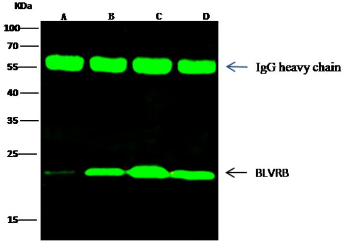 Immunoprecipitation - Anti-FLR antibody [009] - BSA and Azide free (AB276064), expandable thumbnail
