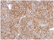 Immunohistochemistry (Formalin/PFA-fixed paraffin-embedded sections) - Anti-FLRT2 antibody (AB154023)