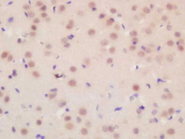 Immunohistochemistry (Formalin/PFA-fixed paraffin-embedded sections) - Anti-FLRT3 antibody (AB214188)