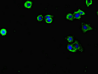 Immunocytochemistry/ Immunofluorescence - Anti-FLRT3 antibody (AB223047)