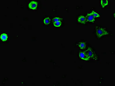 Immunocytochemistry/ Immunofluorescence - Anti-FLRT3 antibody (AB223047)