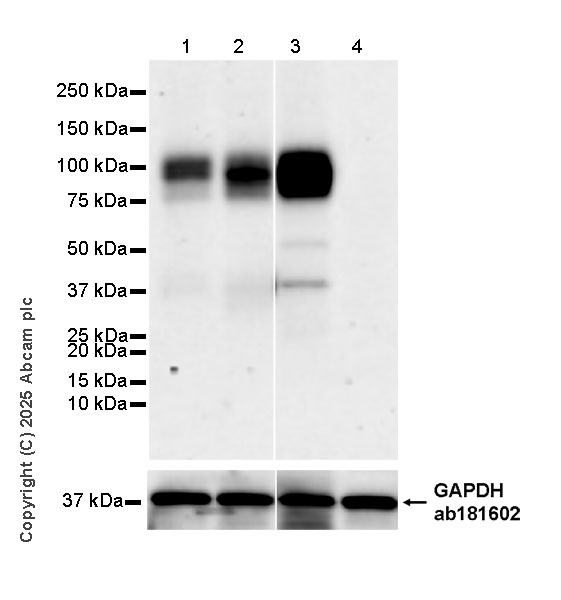 Western blot - Anti-FLRT3 antibody [EPR29132-87] (ab323410), expandable thumbnail