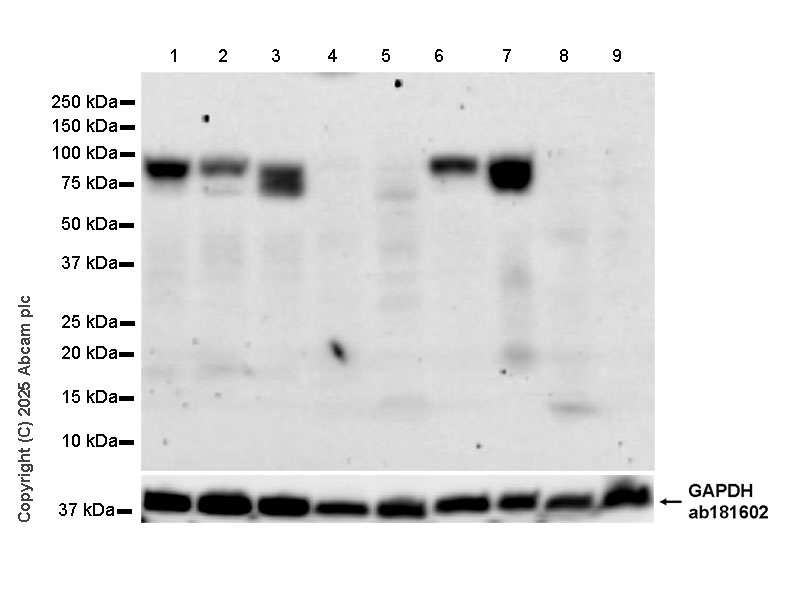 Western blot - Anti-FLRT3 antibody [EPR29132-87] (AB323410), expandable thumbnail