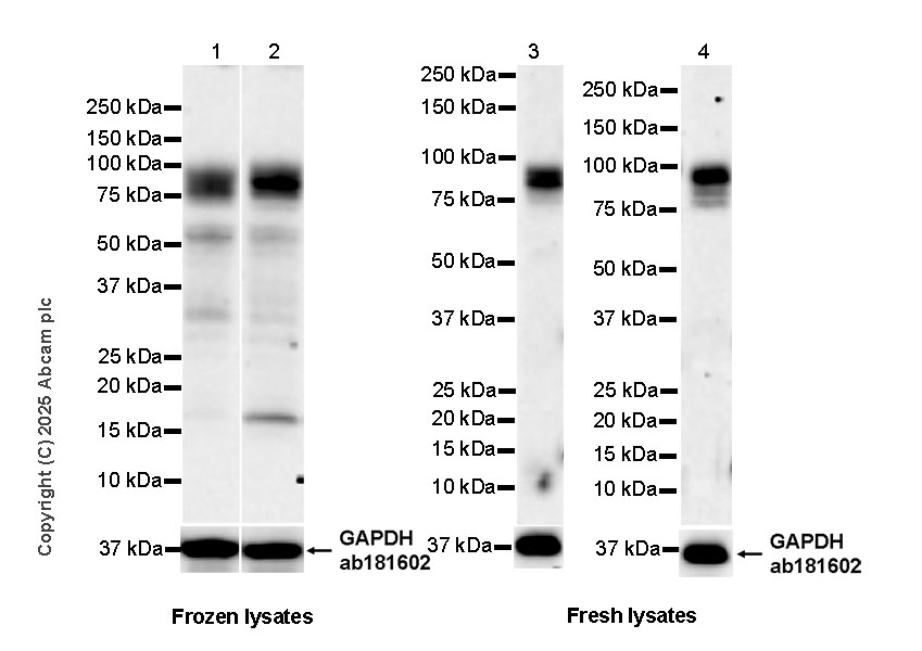 Western blot - Anti-FLRT3 antibody [EPR29132-87] (AB323410), expandable thumbnail