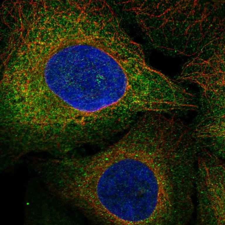 Immunocytochemistry/ Immunofluorescence - Anti-Flt 3 / Flk 2 antibody (AB262844)