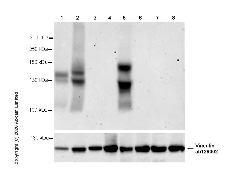 Western blot - Anti-FLT3 antibody [EPR31042-551] (AB326101)