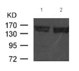 Western blot - Anti-Flt3 / CD135 antibody (AB131545)