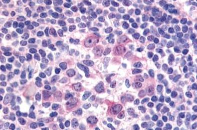Immunohistochemistry (Formalin/PFA-fixed paraffin-embedded sections) - Anti-Flt3 / CD135 antibody (AB150599), expandable thumbnail