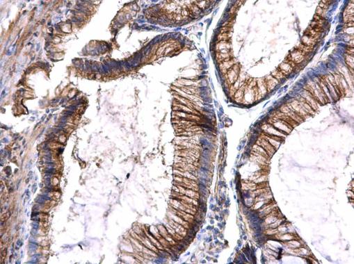 Immunohistochemistry (Formalin/PFA-fixed paraffin-embedded sections) - Anti-Flt3 / CD135 antibody (AB227171)