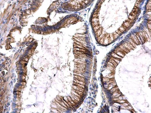 Immunohistochemistry (Formalin/PFA-fixed paraffin-embedded sections) - Anti-Flt3 / CD135 antibody (AB227171)