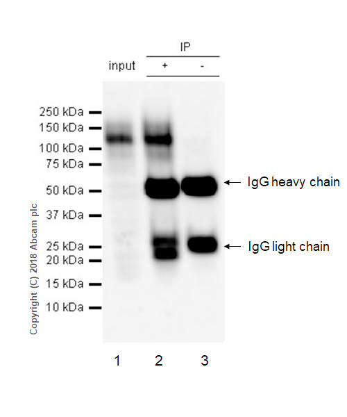 Immunoprecipitation - Anti-Flt3 / CD135 antibody [EPR22232-318] (AB245116), expandable thumbnail
